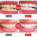 All Smiles- Teeth Whitener, Stain Removing & Bed Breath Removing Toohpaste